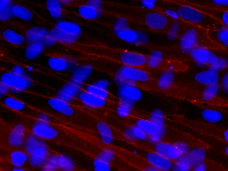 AO Human Liver-Derived Endothelial Cells