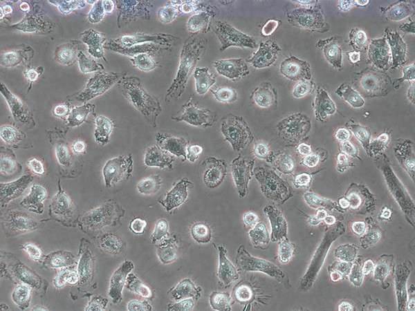 Periph. Blood CD14+ Cells 10 million