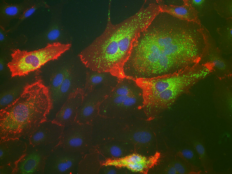 HPAEC-Pulmon. Artery Endo ,EGM-2, amp