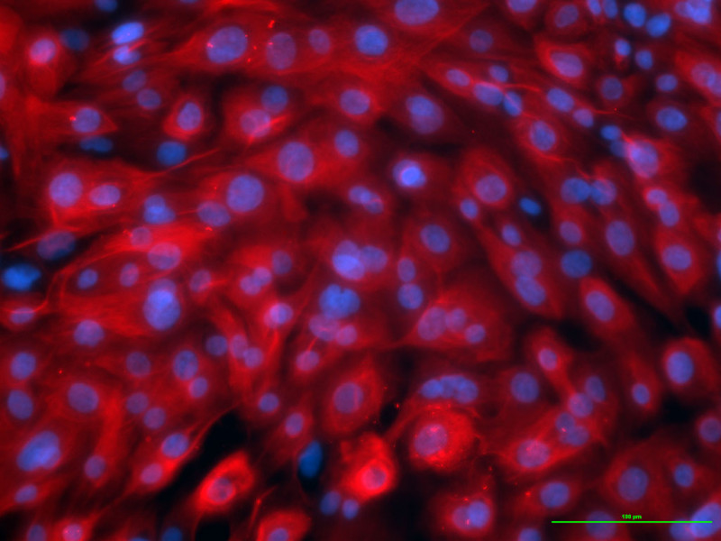 NHBE-Bronchial Epi Cells w/RA, BEGM,cryo