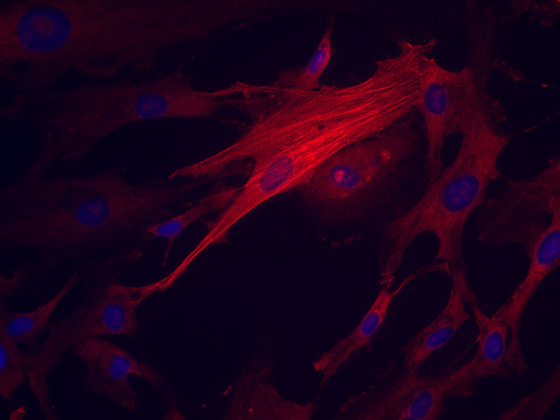 NHA-Astrocytes AGM, 6 well plate