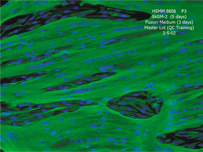 HSMM-Muscle Myoblasts SkGM-2, cryo amp