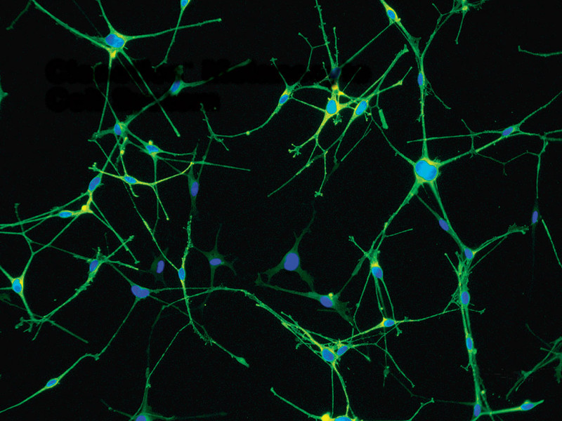 Adult Melanocyte(NHEM-Ad) Cell, 500K/amp