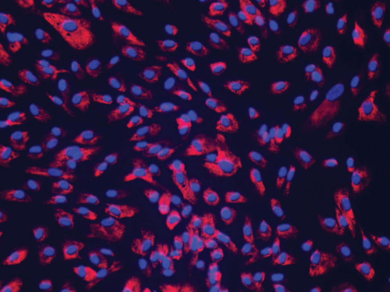 NHCF-V Human Cardiac Fibroblasts-Vent