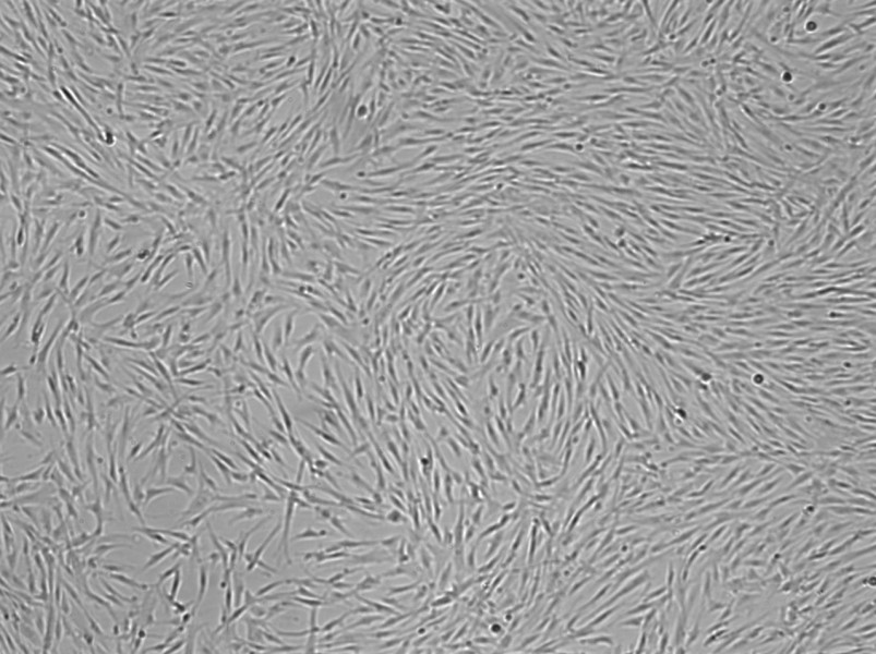 Diseased Human Lung Fibroblasts (iPF)