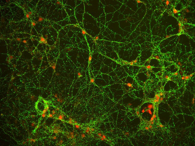 Mouse C57 Striatum Neuron Cryo, 4 mil