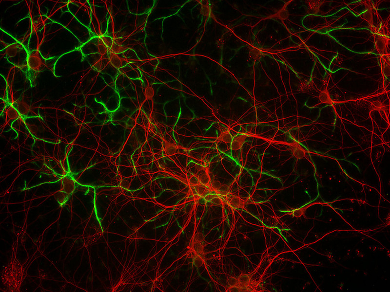 Mouse C57 Cortex Neurons Cryo, 4 mil