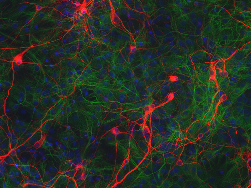 Rat Hypothalamic Neurons